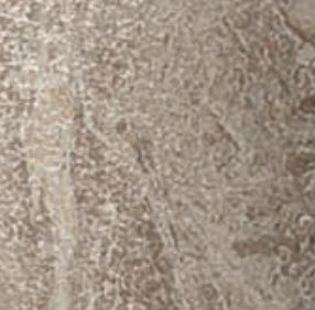 Вставка Privilege Grigio Bottone Lappato / Привиледж Гриджио Лаппато керамогранит